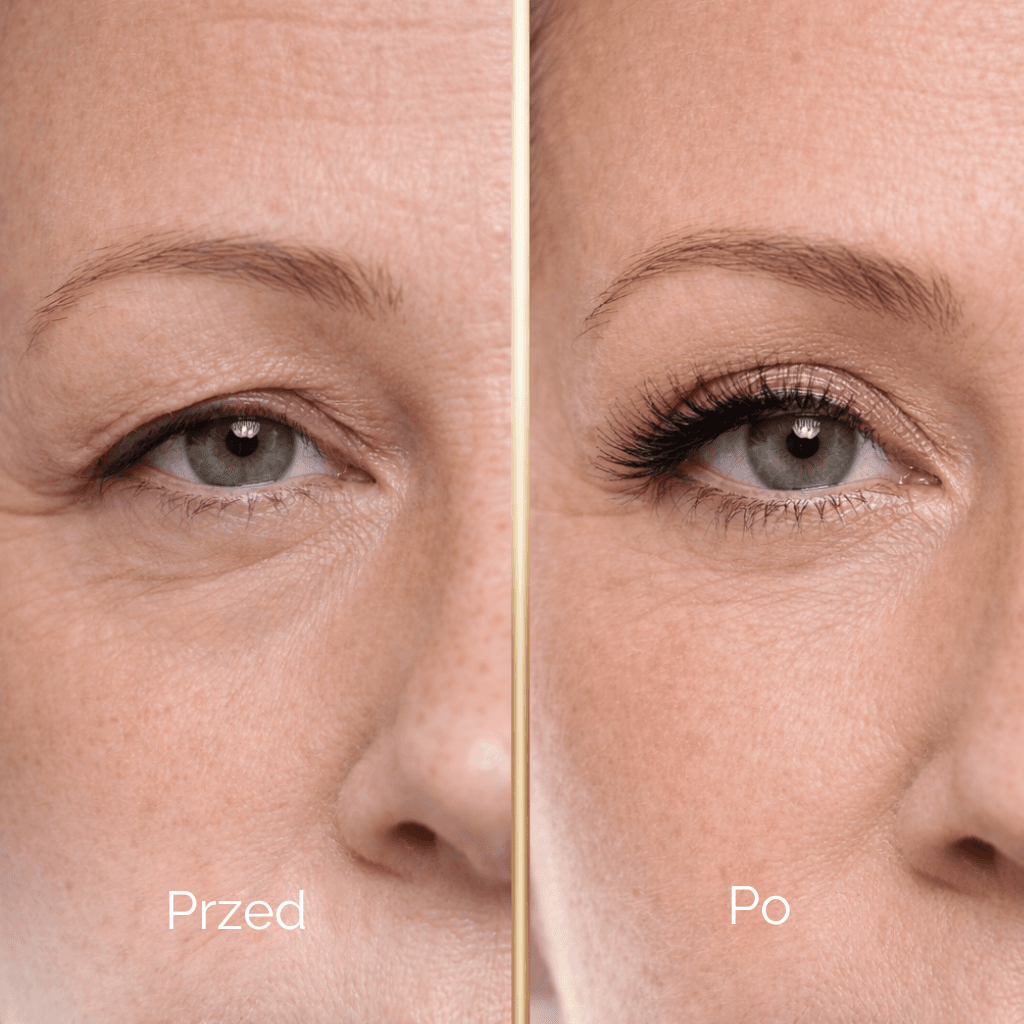 Liftique–  Taśmy liftingujące - Unieś Powieki w 30 sekund (480 szt)