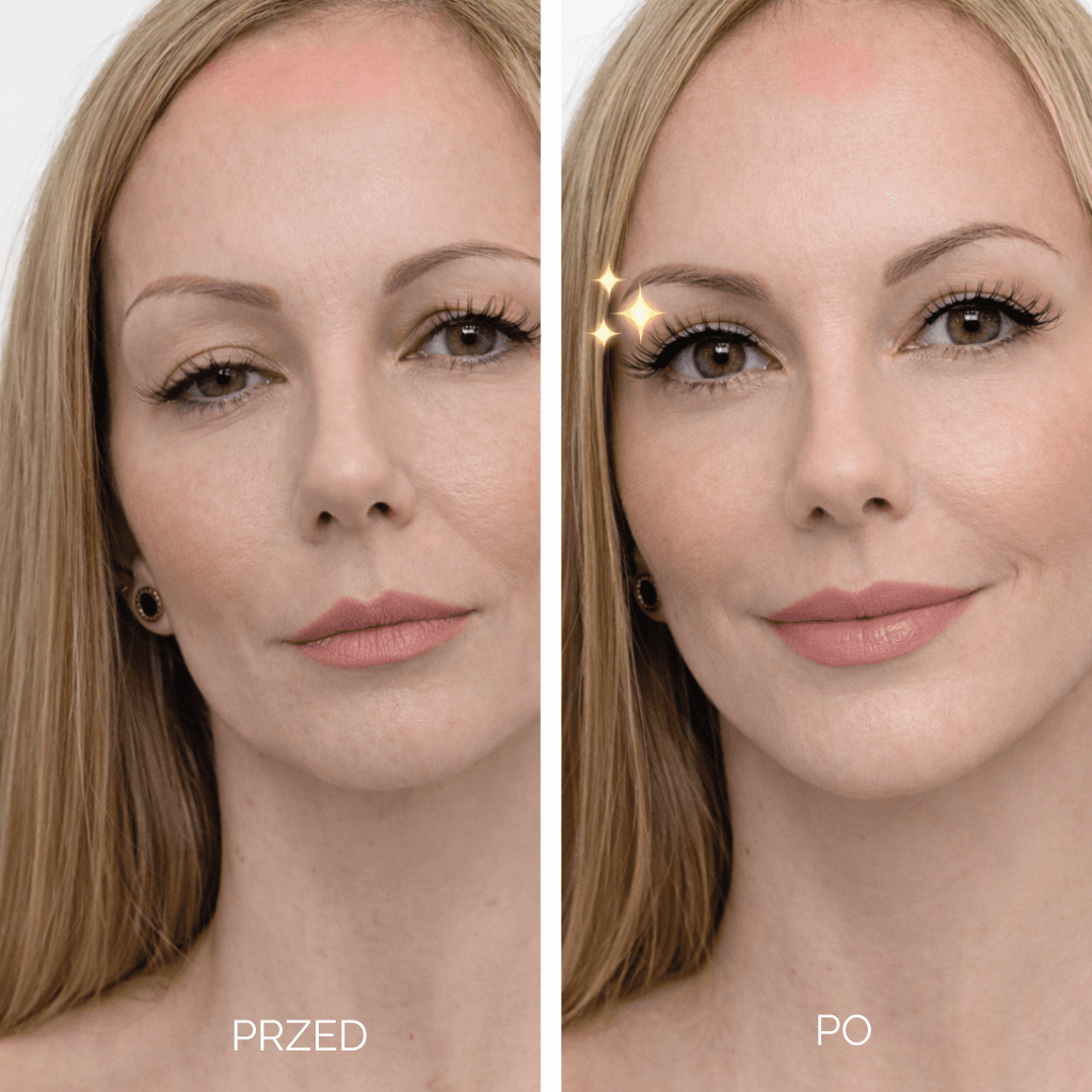 Liftique–  Taśmy liftingujące - Unieś Powieki w 30 sekund (480 szt)