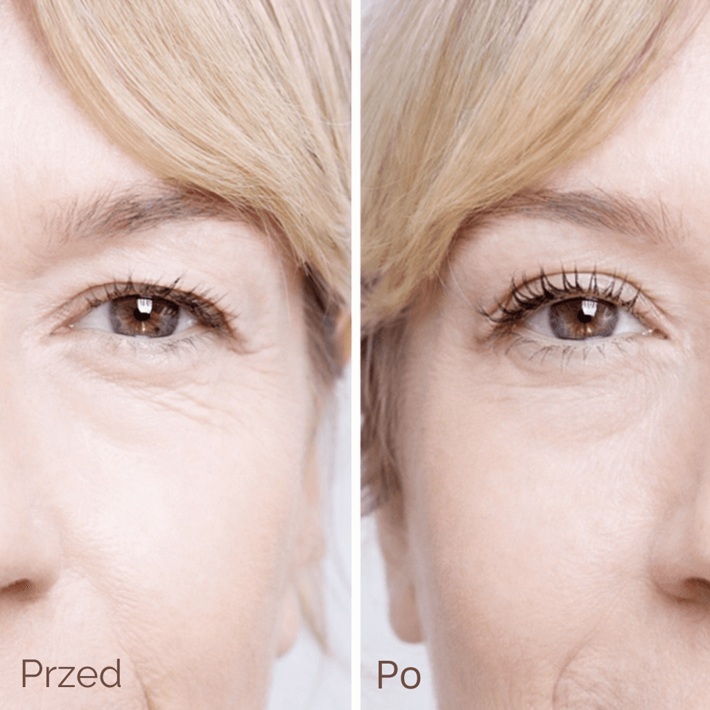 Liftique–  Taśmy liftingujące - Unieś Powieki w 30 sekund (480 szt)