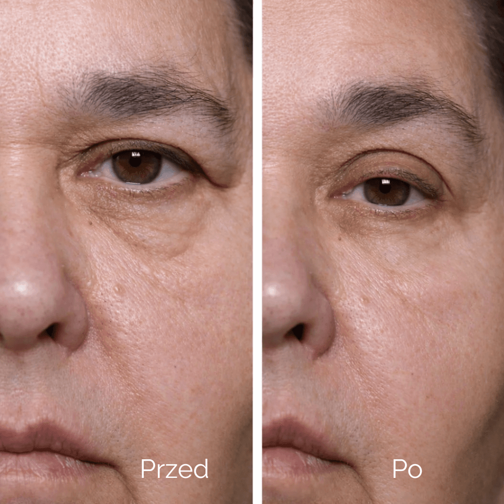 Liftique–  Taśmy liftingujące - Unieś Powieki w 30 sekund (480 szt)